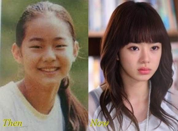School Aged Pictures Of Popular Hallyu K Actresses Show The Before And 